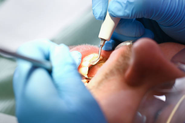Best After-Hours Emergency Dentist in Crowley, TX